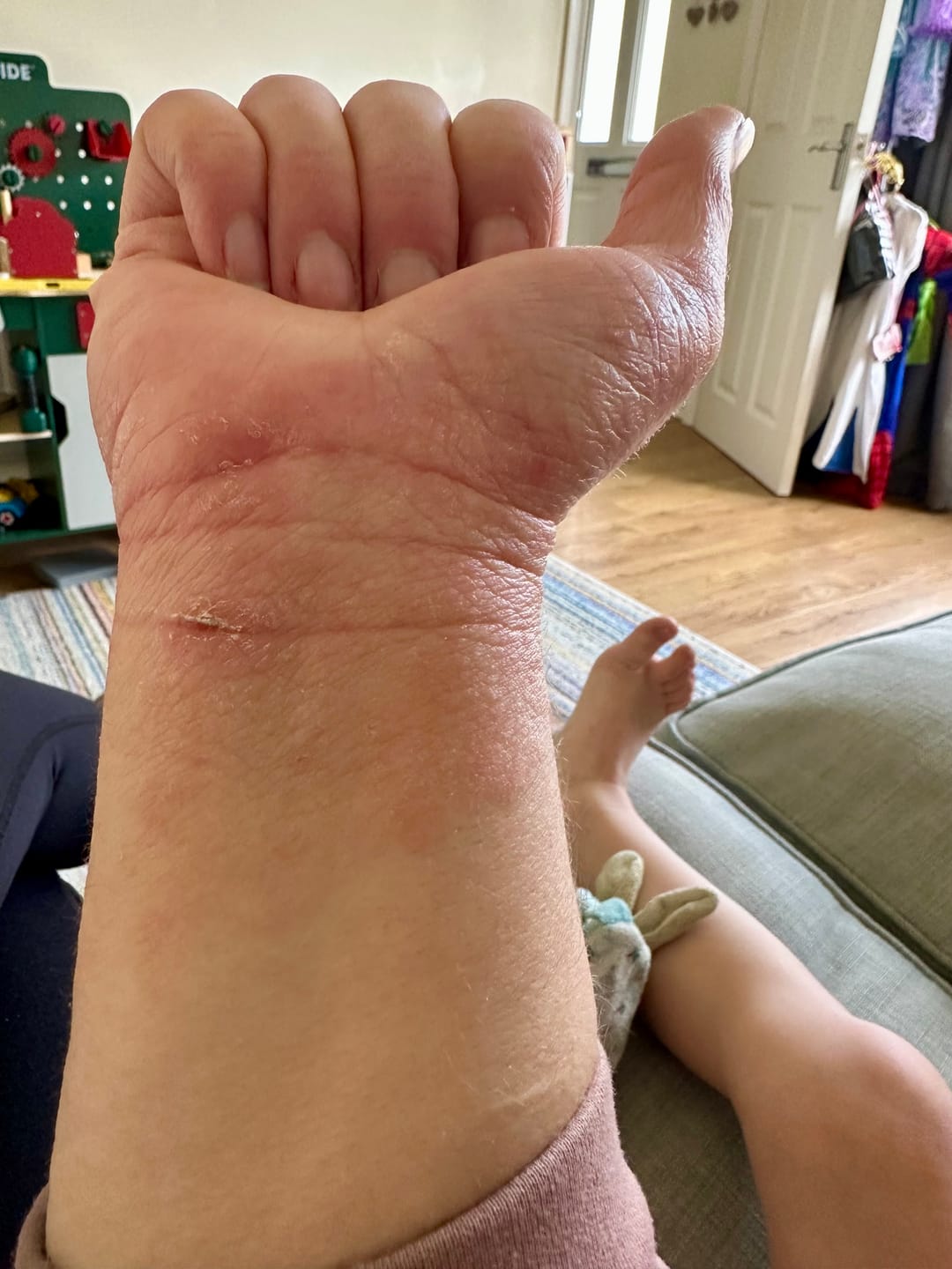 Customer photo review of Bioskin Zeoderm Skin Repair Moisturiser
