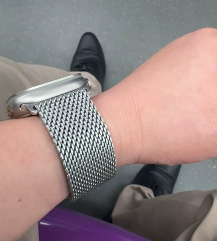 Customer photo review of Ultimate Titanium Milanese Loop Strap for Apple Watch