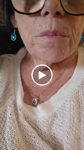 Customer video review of Imako® Cosmetic Teeth – Refill Kit