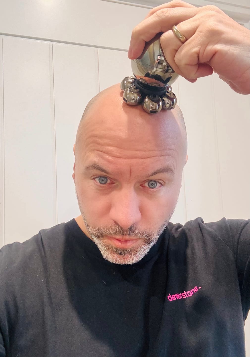 Customer photo review of Trim Pod 2.0 Kit