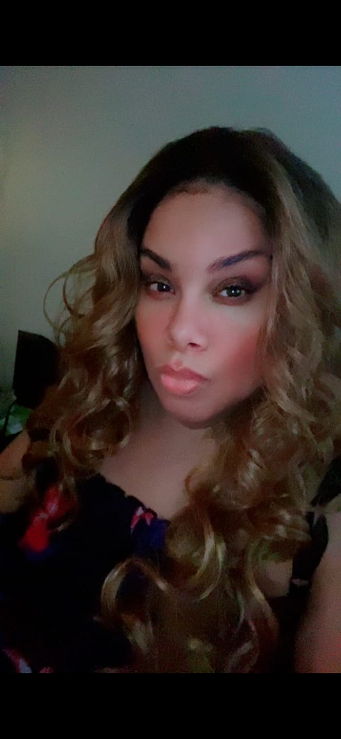 Customer photo review of The Complete All in One Wig Install Kit
