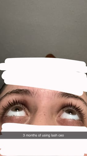 Customer photo review of Lash Growth Serum