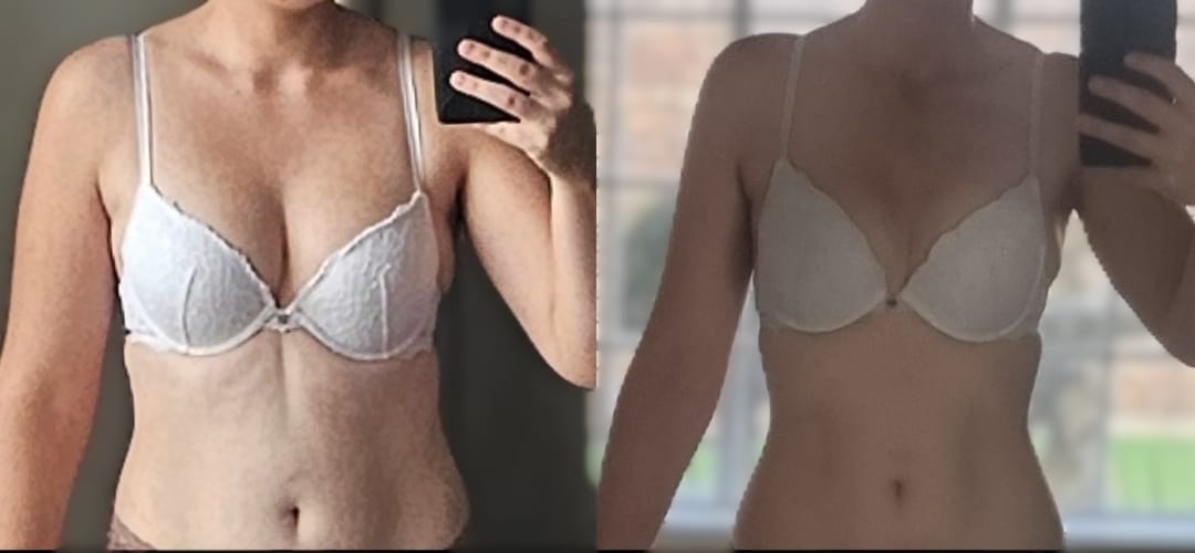 Customer photo review of Tesofensine Peptide Capsules: Cutting-Edge Weight Loss Support