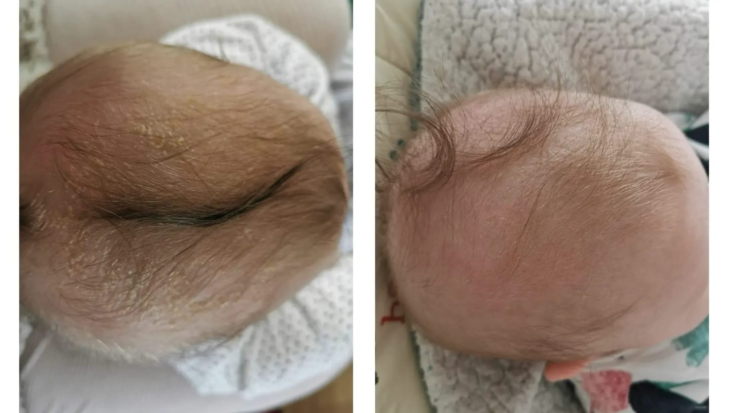 Customer photo review of Baby Scalp Oil