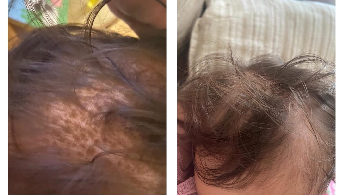 Customer photo review of Baby Scalp Oil