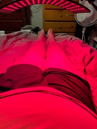 Customer photo review of Red Light Therapy Device