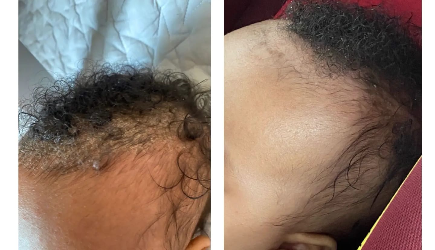Customer photo review of Baby Scalp Oil