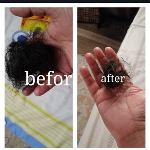 Customer photo review of Hair Revival Set