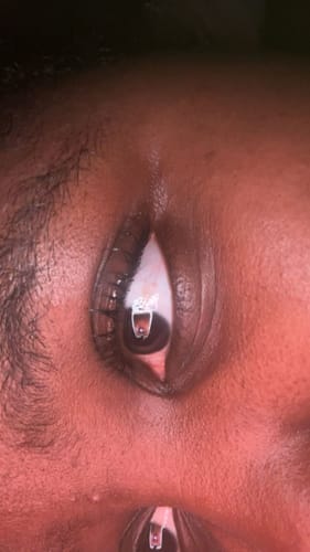 Customer photo review of Lash Growth Serum