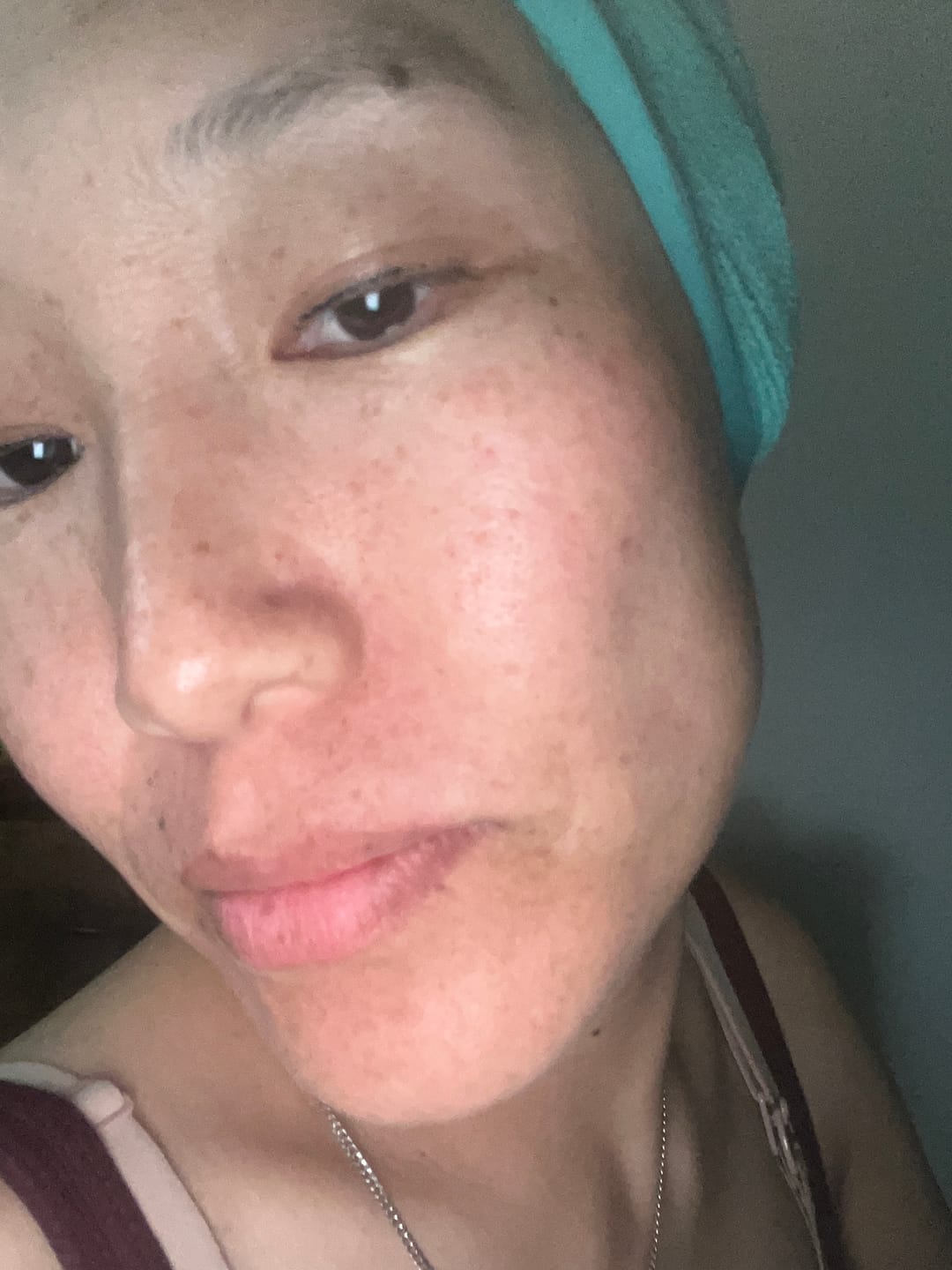 Customer photo review of [Beauty Of Joseon] Revive Eye Serum : Ginseng + Retinal 30ml