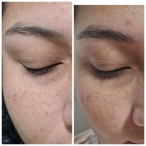 Customer photo review of Suero para pestañas y cejas