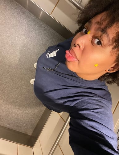 Customer photo review of Star Shaped Pimple Patch