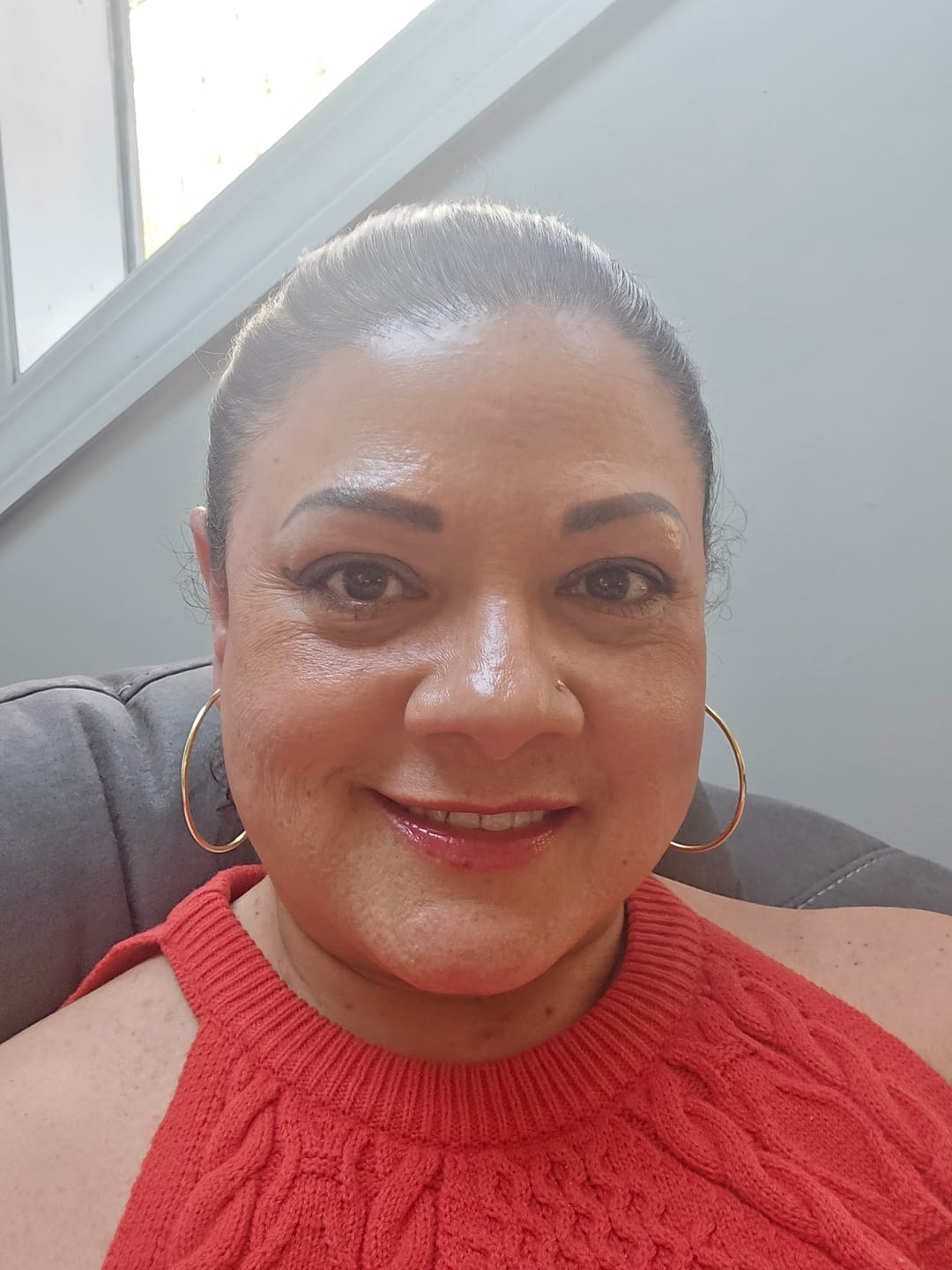 Customer photo review of Glutathiosome dark spot serum Vita drop