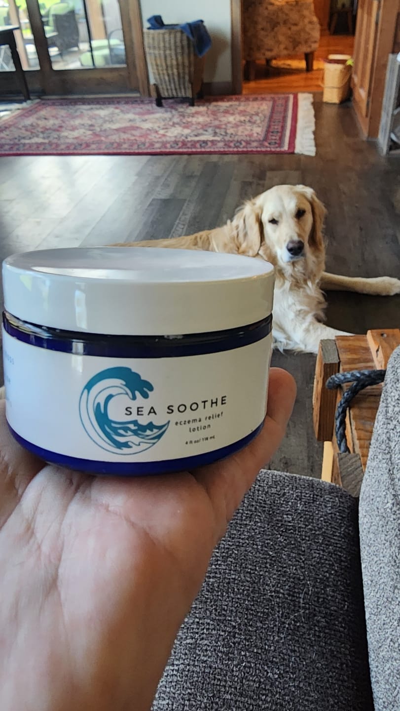 Customer photo review of Sea Soothe Dry Skin Relief Lotion