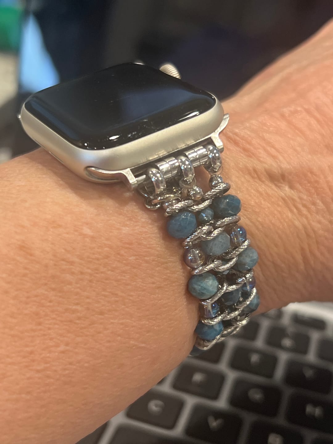 Customer photo review of Apatite Azure Braided Apple Watch Strap