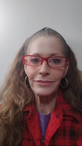 Customer photo review of Glov Micro Infusion System