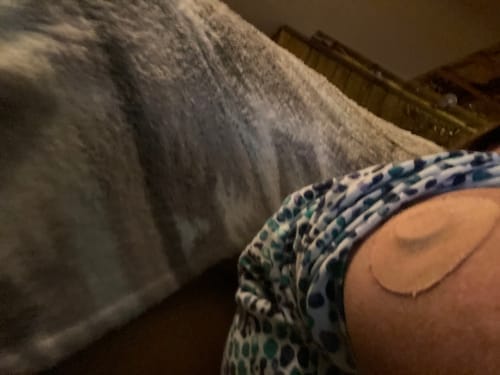 Customer photo review of Skin Grip Original - Libre 3 Adhesive Patches