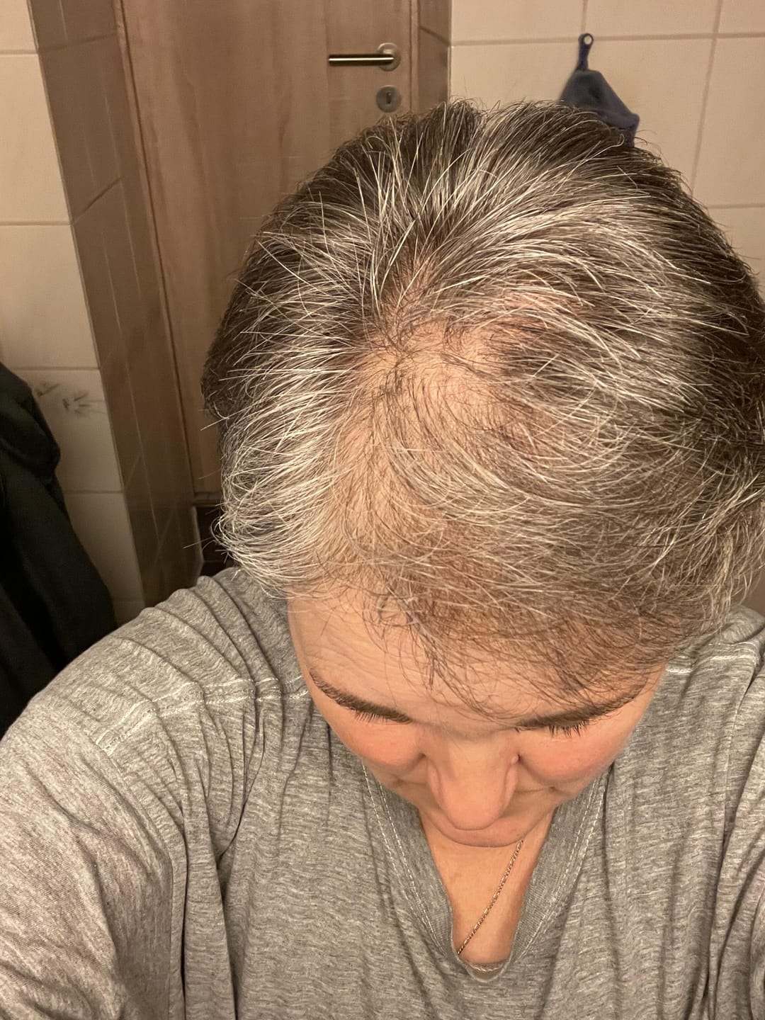 Customer photo review of IMPERIO® Ansatzpuder
