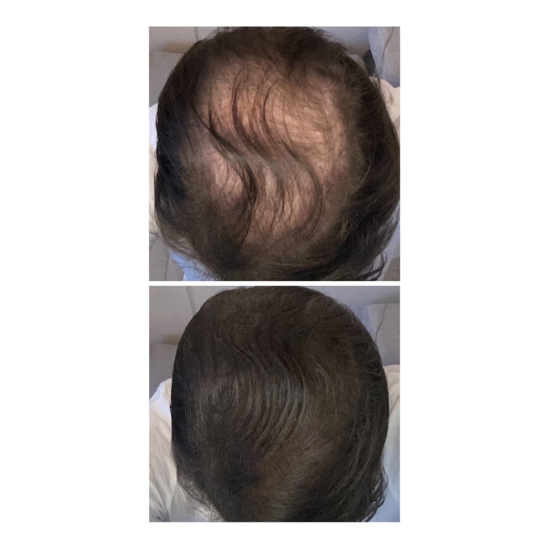Customer photo review of IMPERIO® Streuhaar