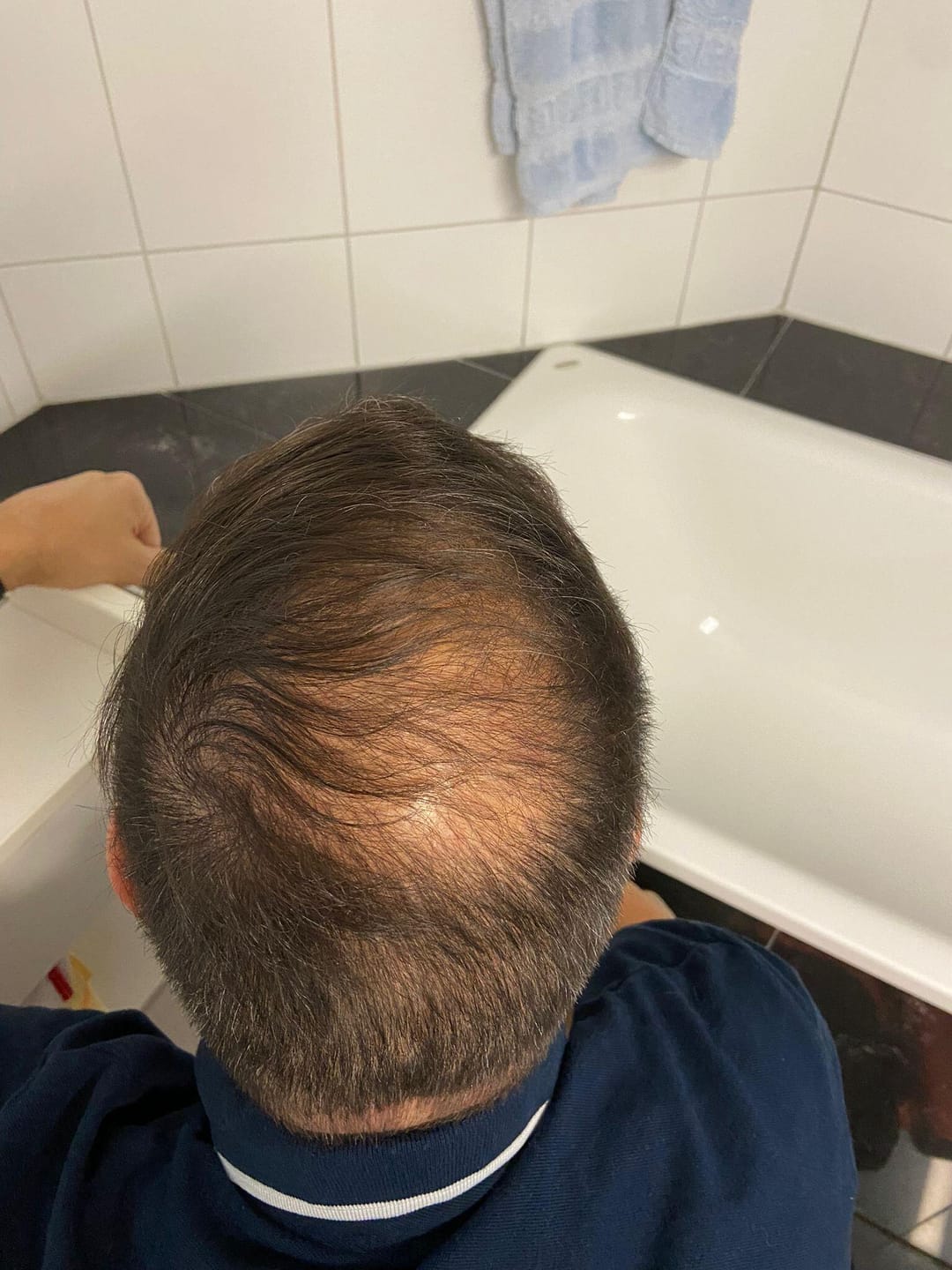 Customer photo review of IMPERIO® Fixierspray 2+1 Gratis