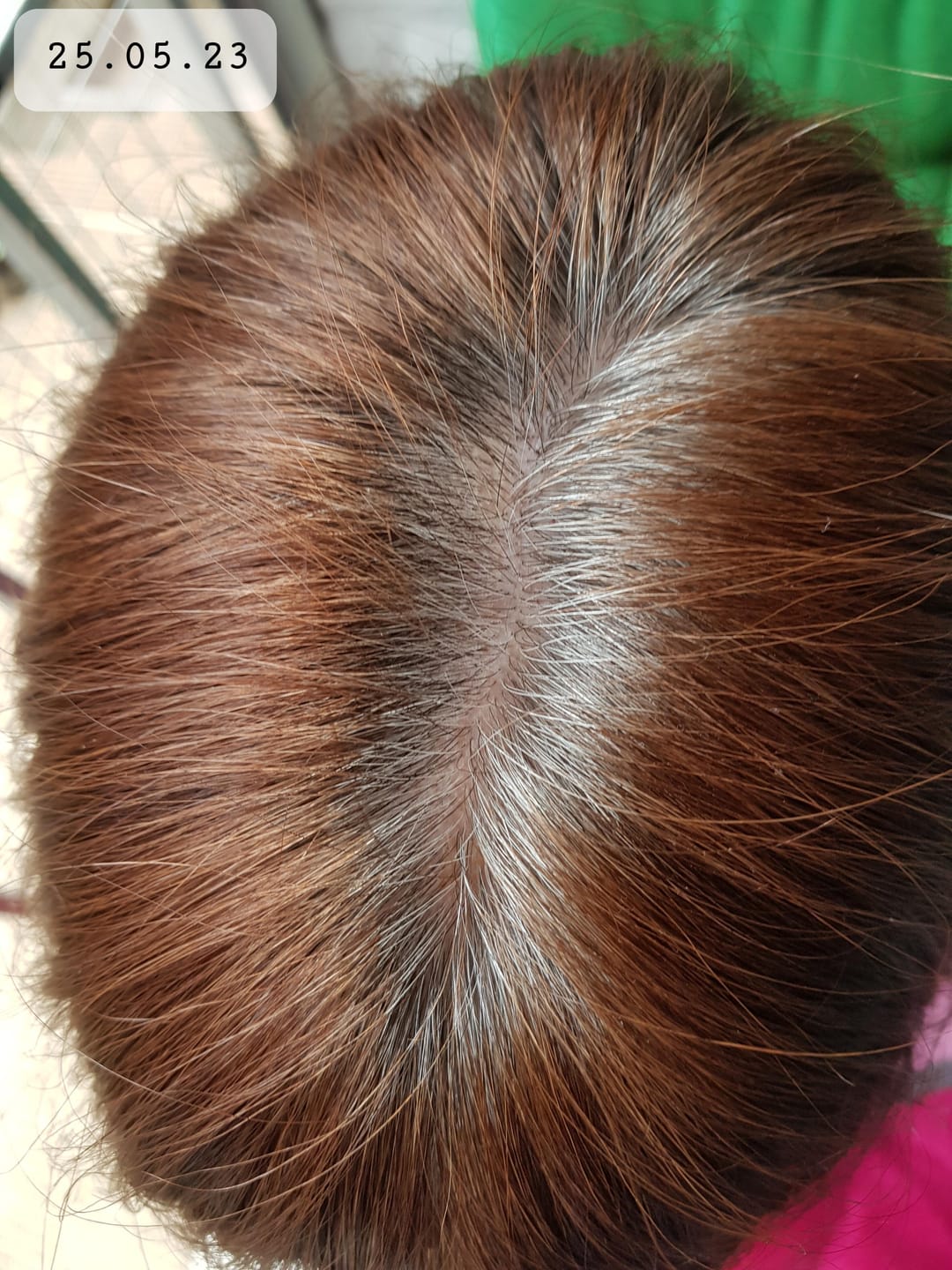 Customer photo review of IMPERIO® Ansatzpuder