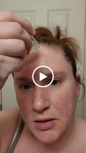 Customer video review of Glov Micro Infusion System