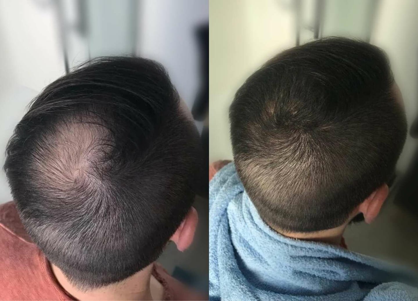 Customer photo review of IMPERIO® Streuhaar