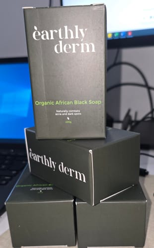Customer photo review of Anti-Acne & Dark Spots African Soap