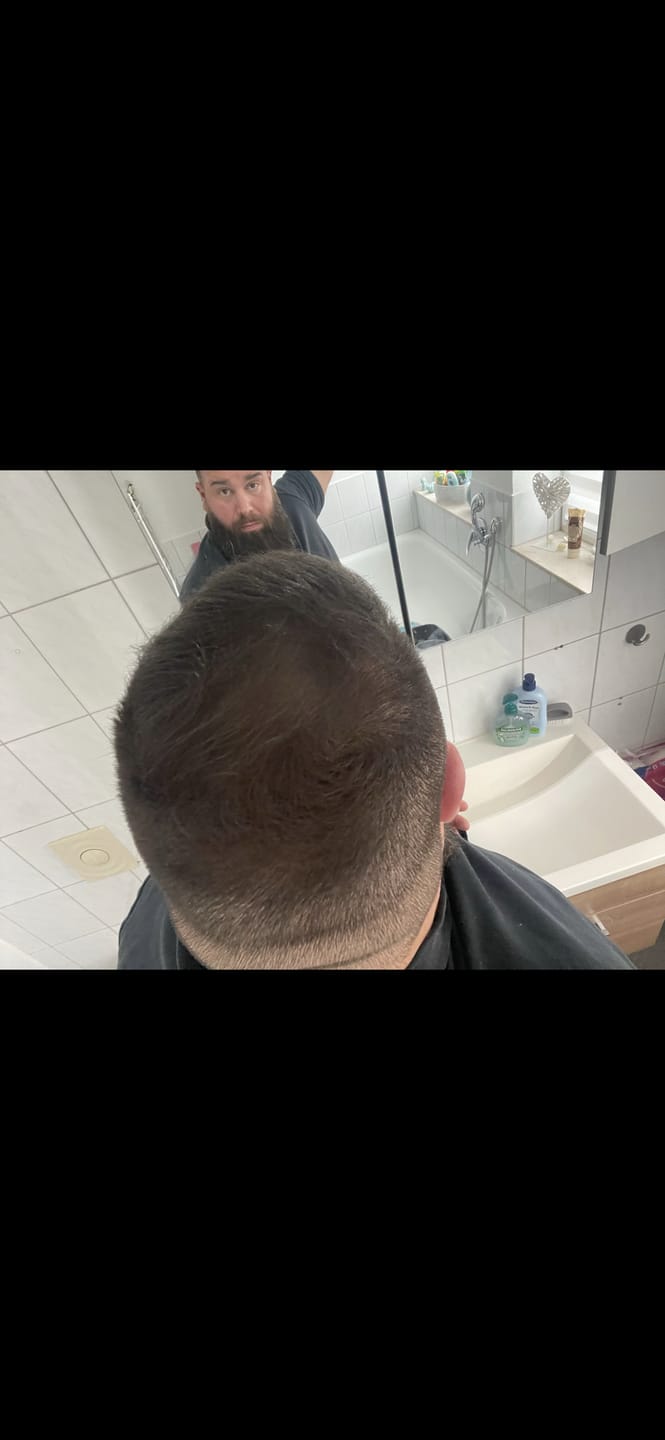 Customer photo review of IMPERIO® Streuhaar