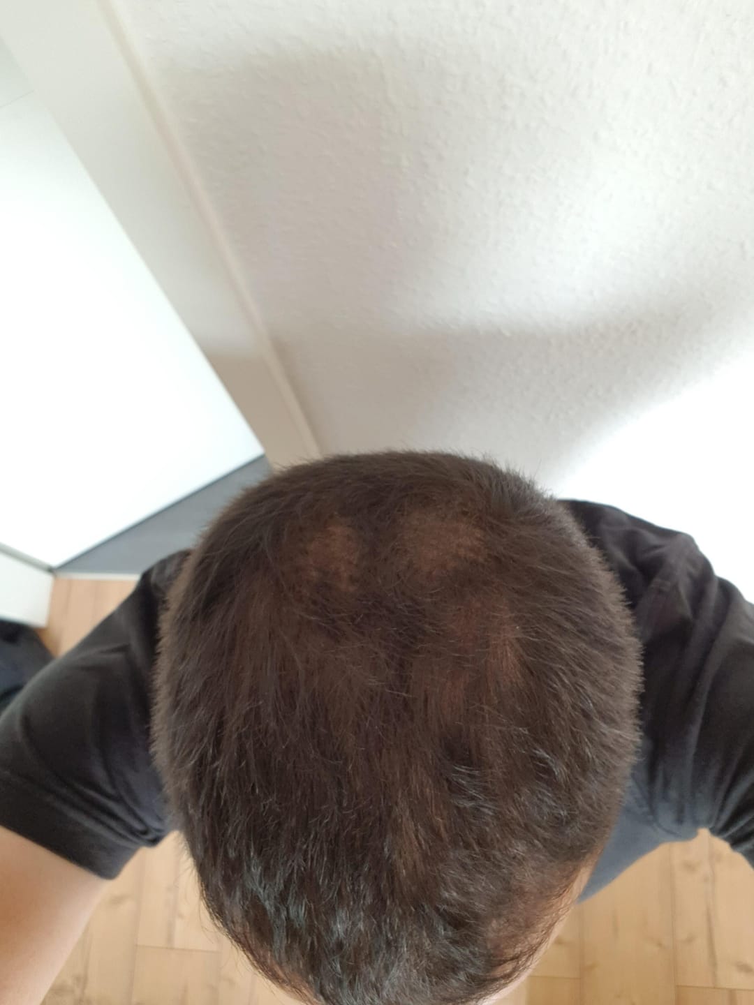 Customer photo review of IMPERIO® Streuhaar