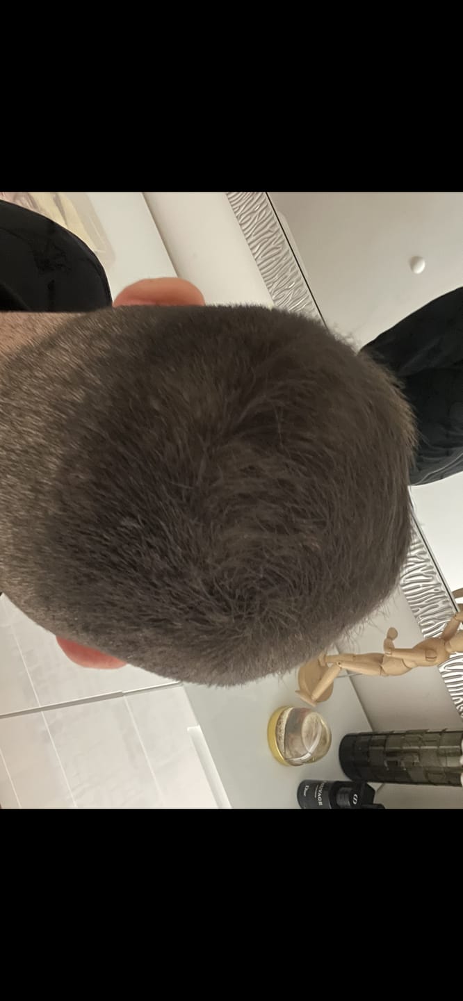 Customer photo review of IMPERIO® Streuhaar