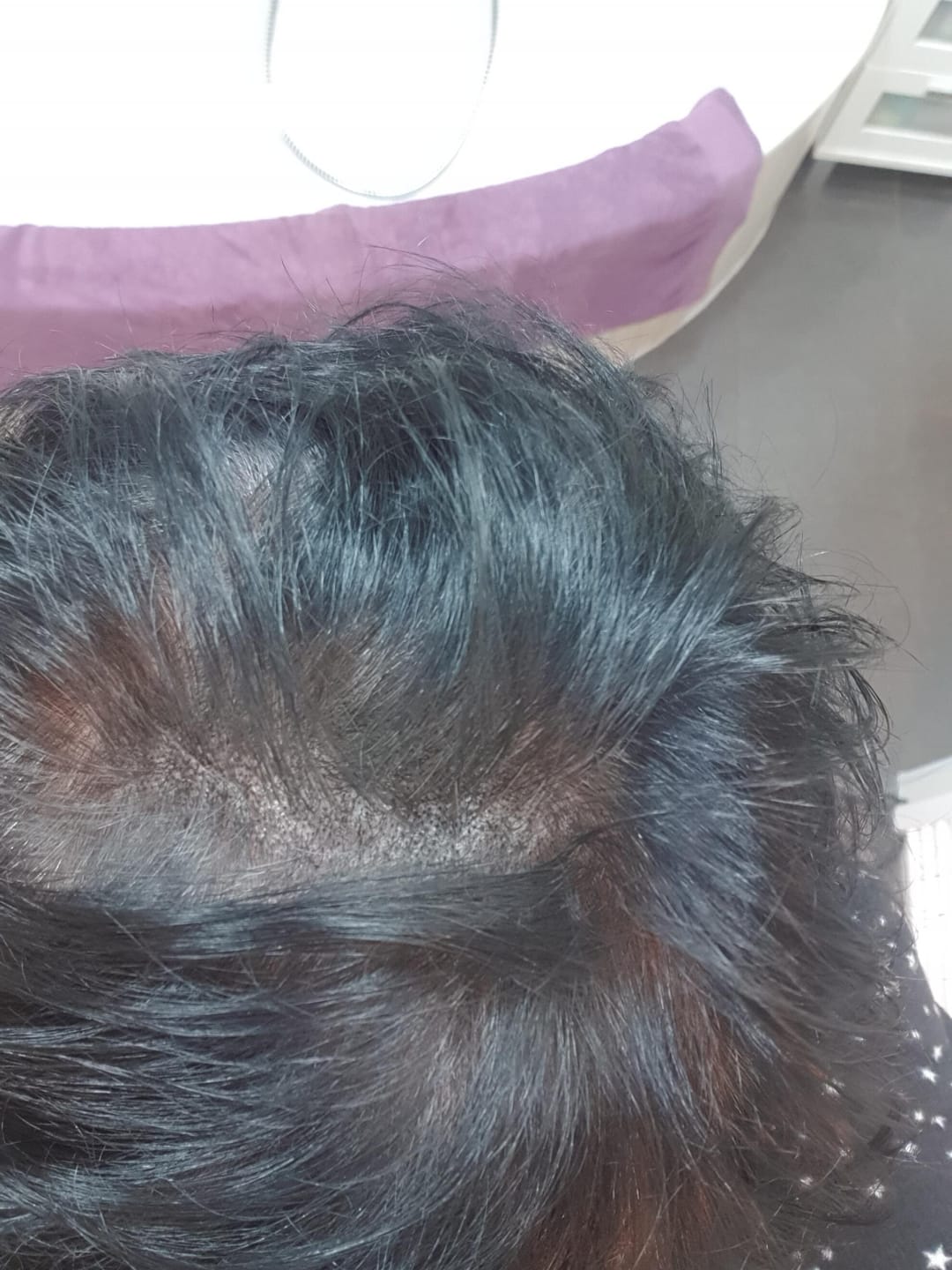 Customer photo review of IMPERIO® Ansatzpuder