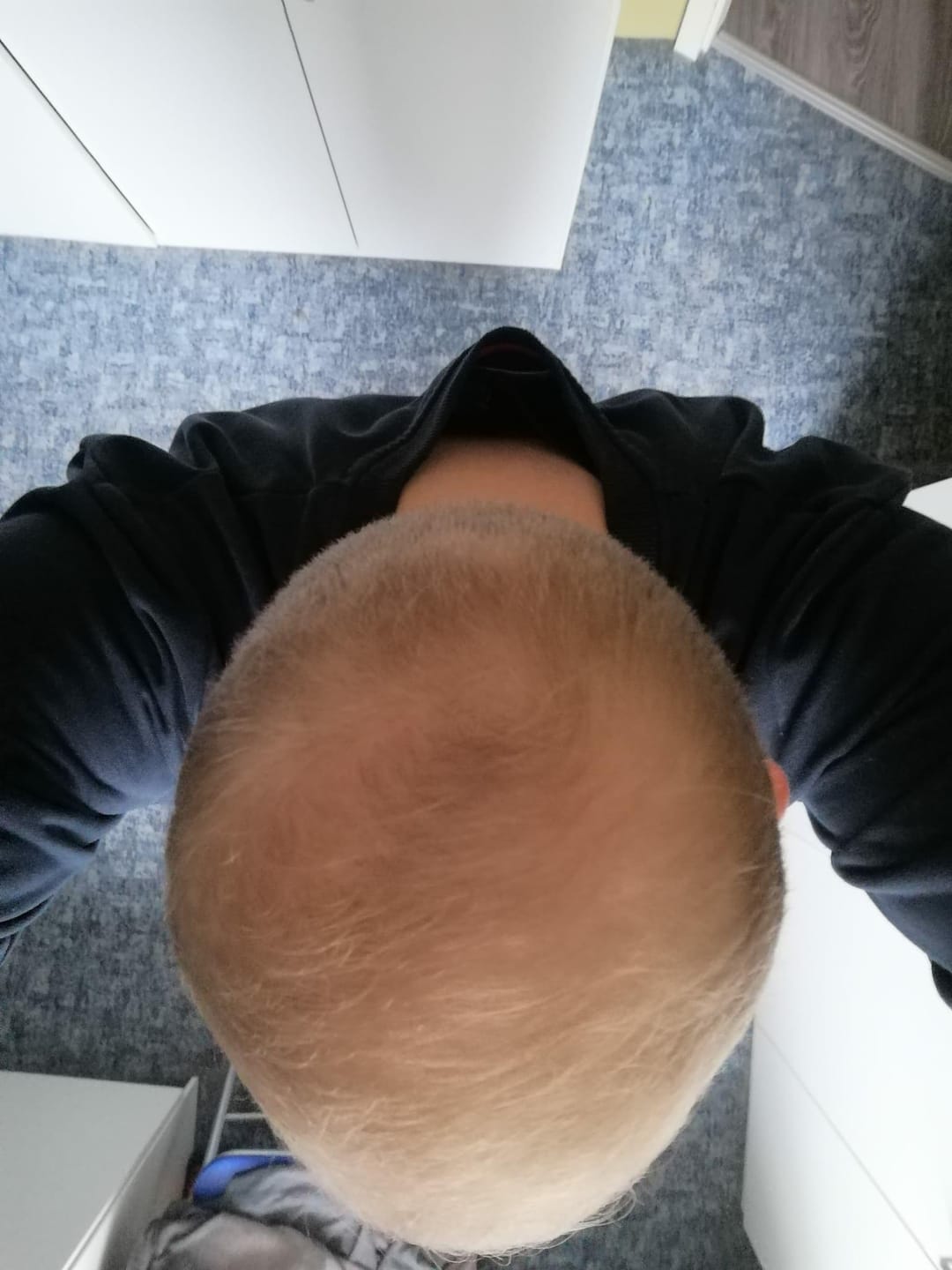 Customer photo review of IMPERIO® Streuhaar