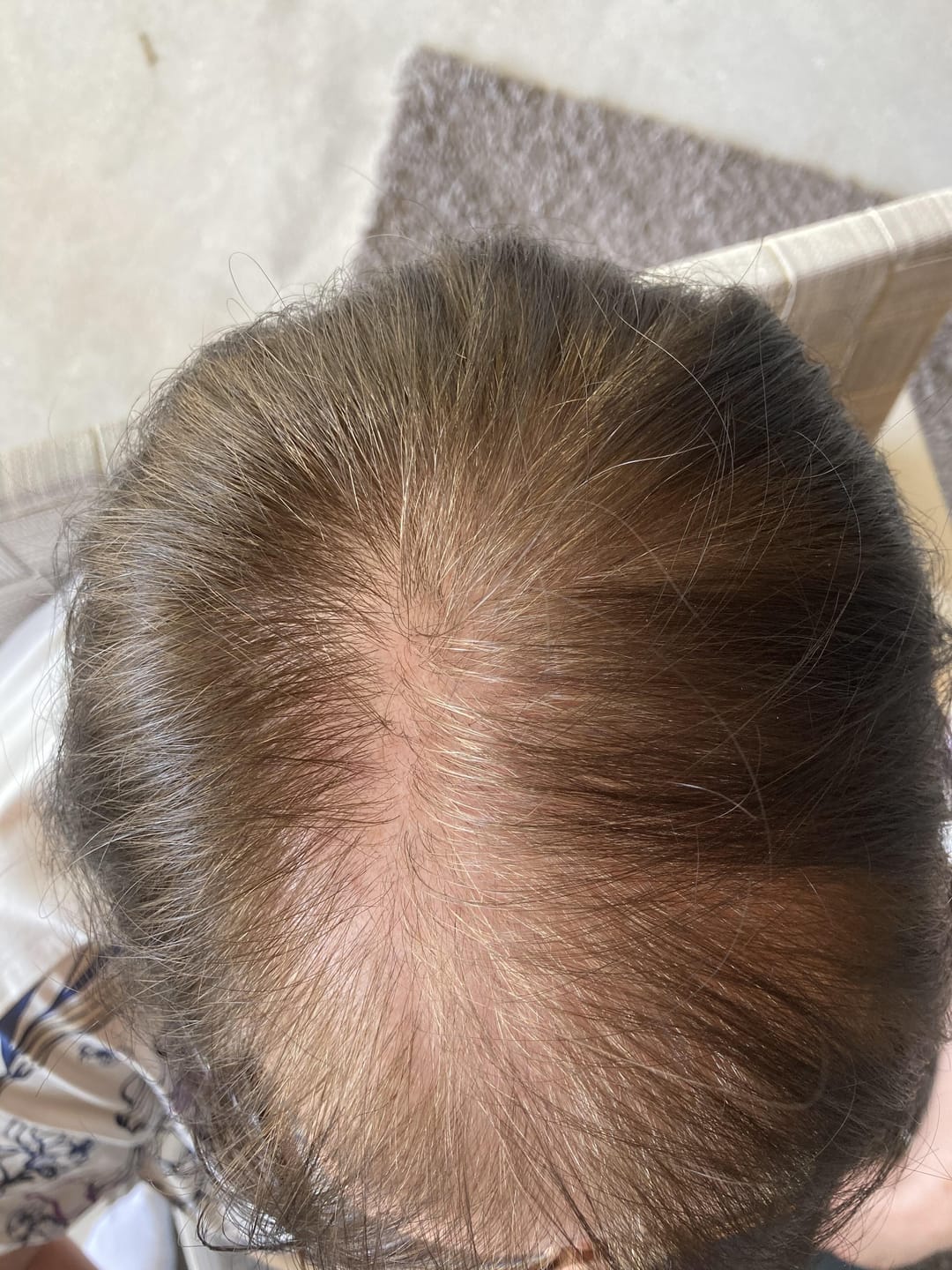 Customer photo review of IMPERIO® Streuhaar