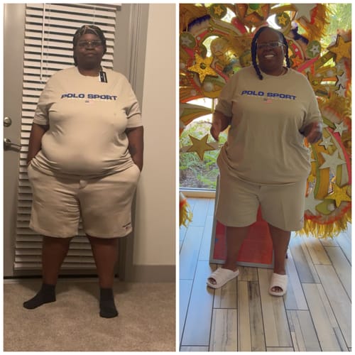 Customer photo review of Semaglutide Weight Loss Program