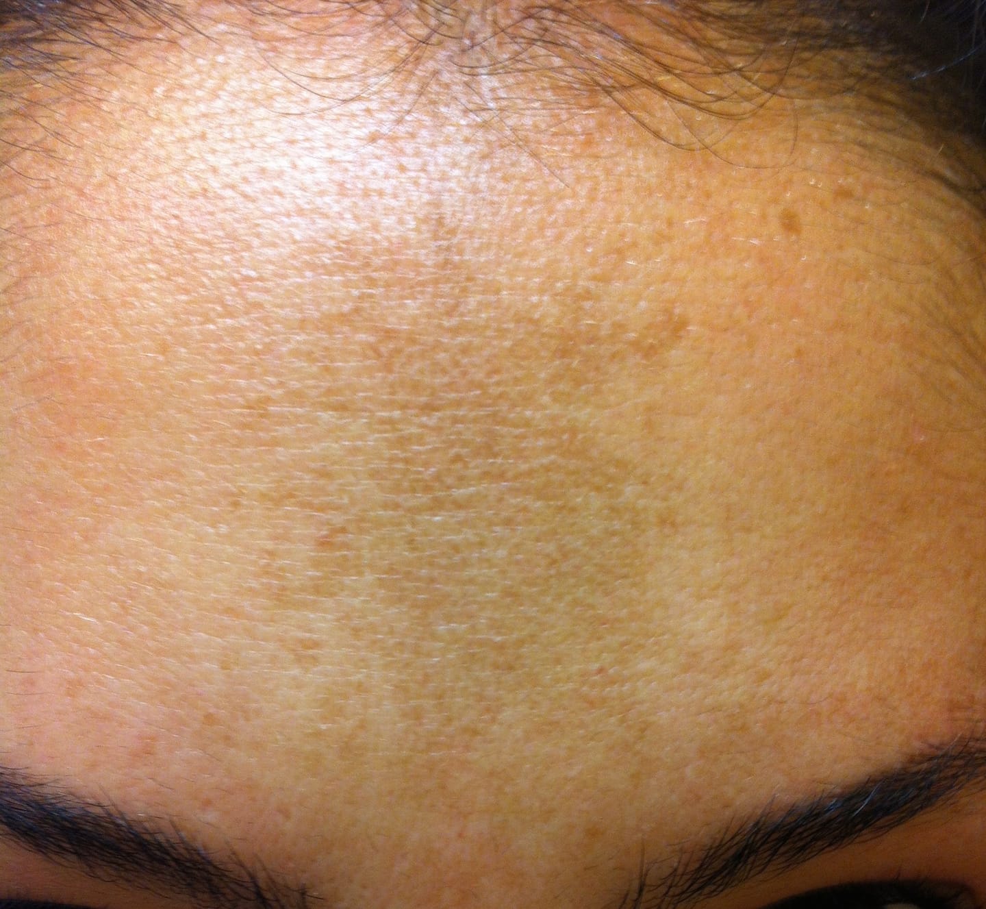 Customer photo review of Lightening illuminating tonic