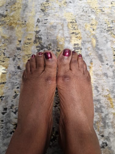 Customer photo review of Anti-Acne & Dark Spots African Soap