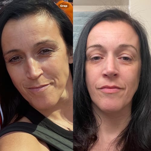 Customer photo review of Glov Micro Infusion System