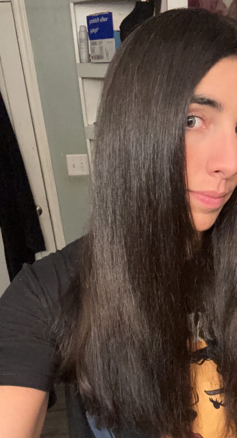 Customer photo review of Rosemary Elixir - 100% Natural Hair Loss Solution