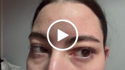 Customer video review of iGlow Lash Maximizer - Lash Serum, 3 ml