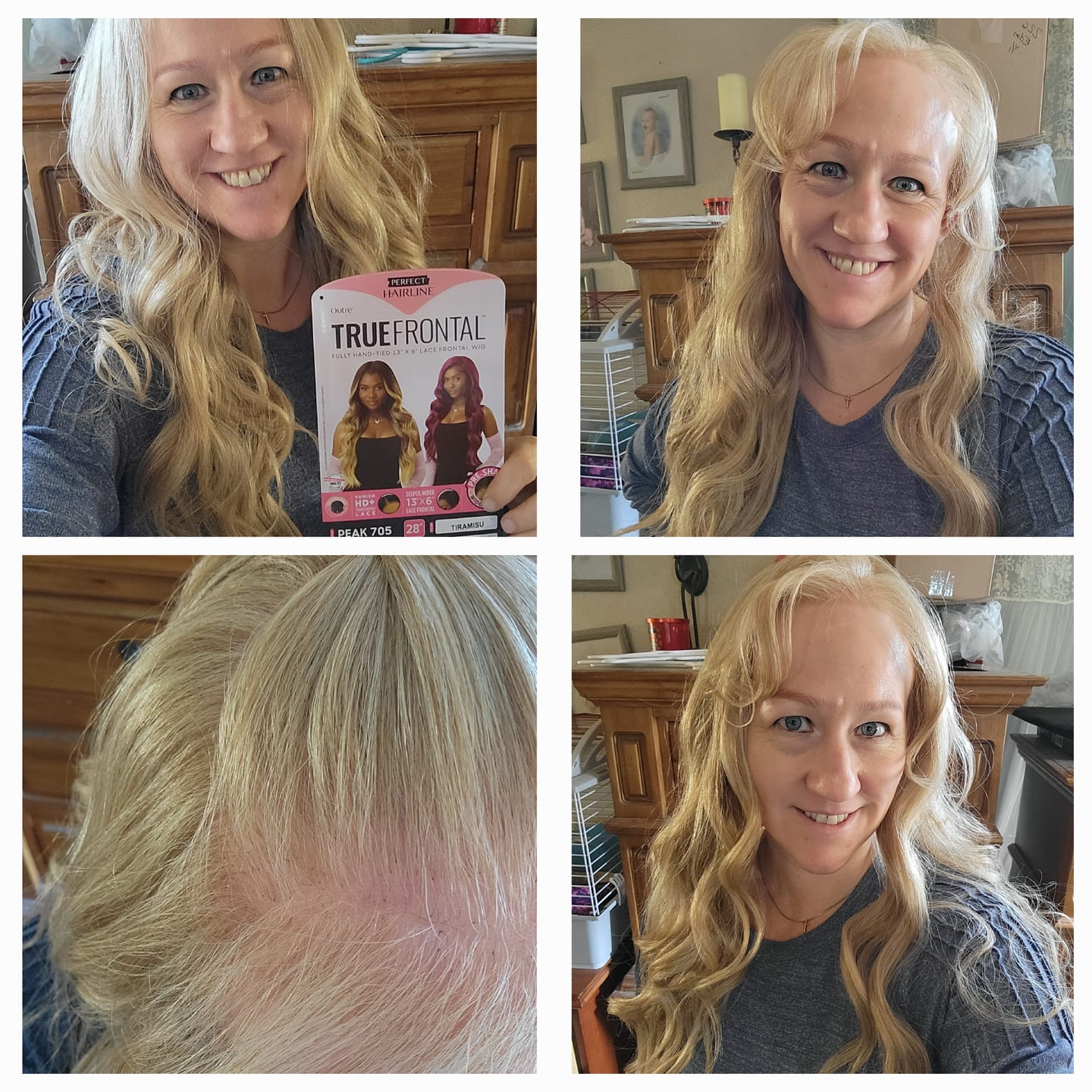 Customer photo review of Outre Perfect Hairline True Frontal Glueless 13x6 HD Lace Front Wig - PEAK 705 - Widow's Peak