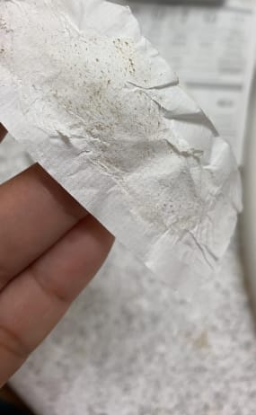 Customer photo review of Deep Cleansing Pore Strips