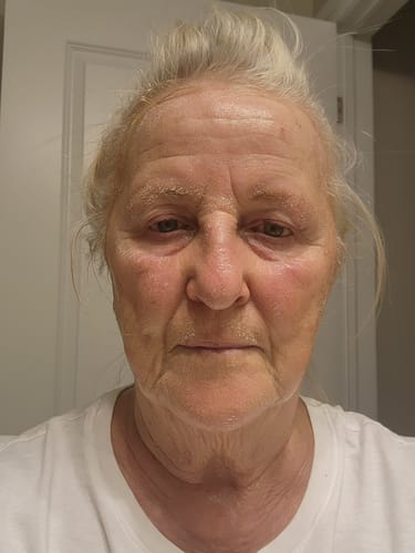 Customer photo review of Face Cleanser