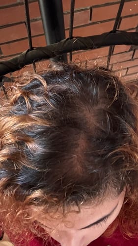 Customer photo review of Scalp Roller