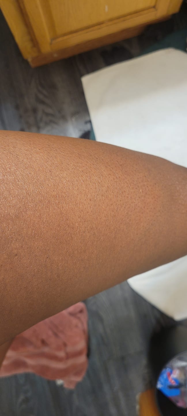 Customer photo review of Brightening Body Oil