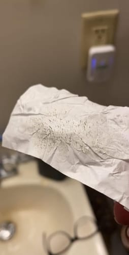 Customer photo review of Deep Cleansing Pore Strips