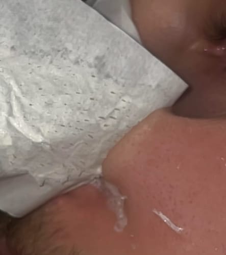 Customer photo review of Deep Cleansing Pore Strips