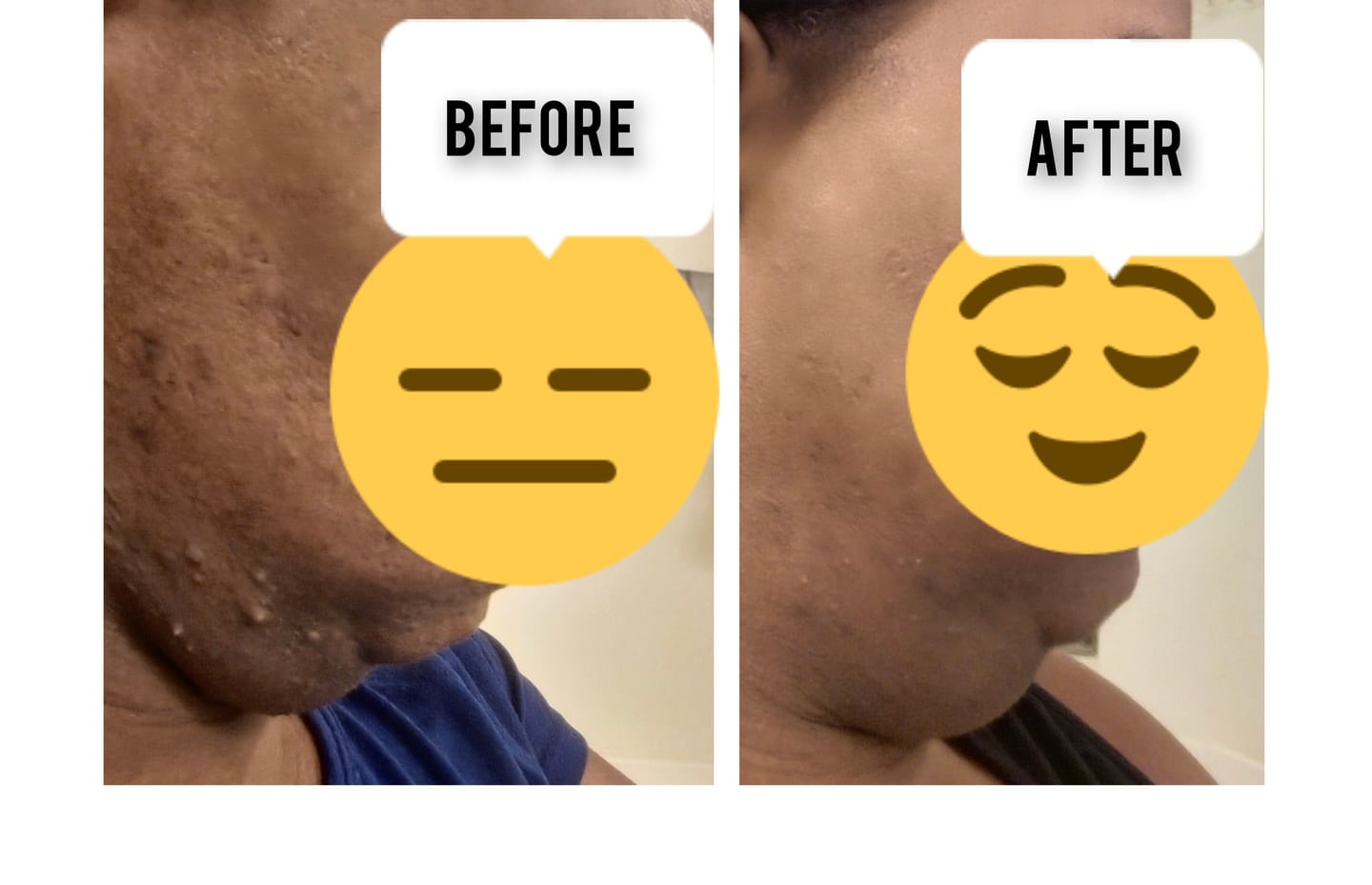 Customer photo review of LIMITED EDITION KIT Jolie’s Mini Full Body & Face Brightening Kit