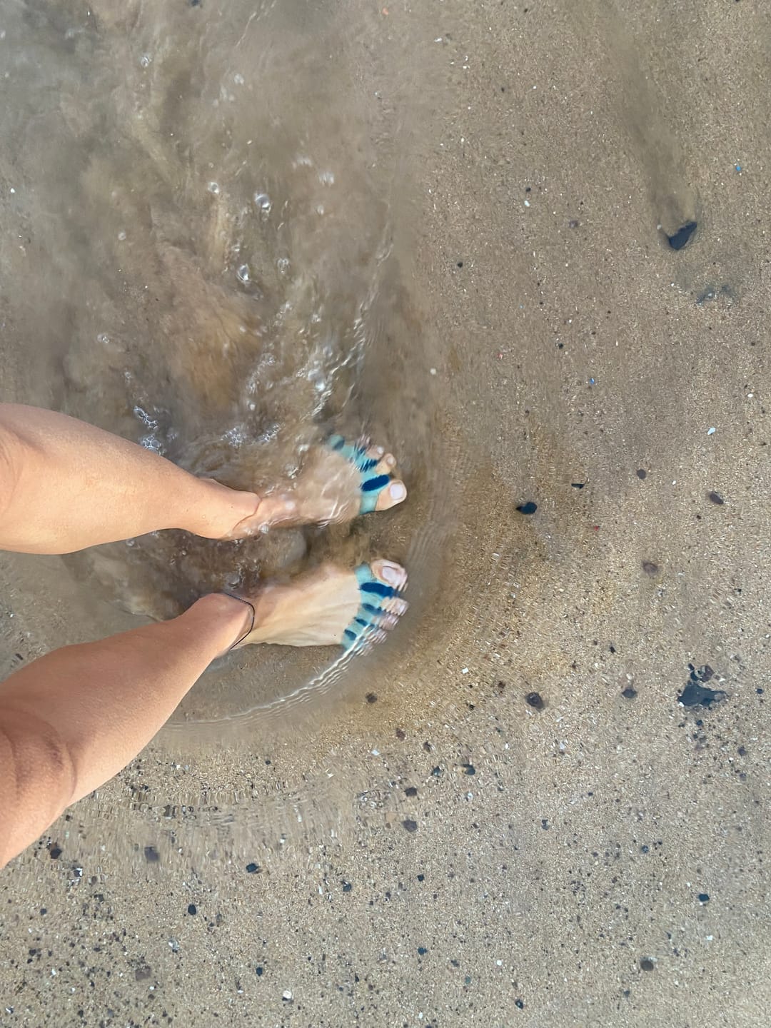 Customer photo review of Separadores de dedos- ADVANCED