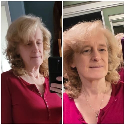 Customer photo review of Anti Aging Moisturizer for Sensitive Skin